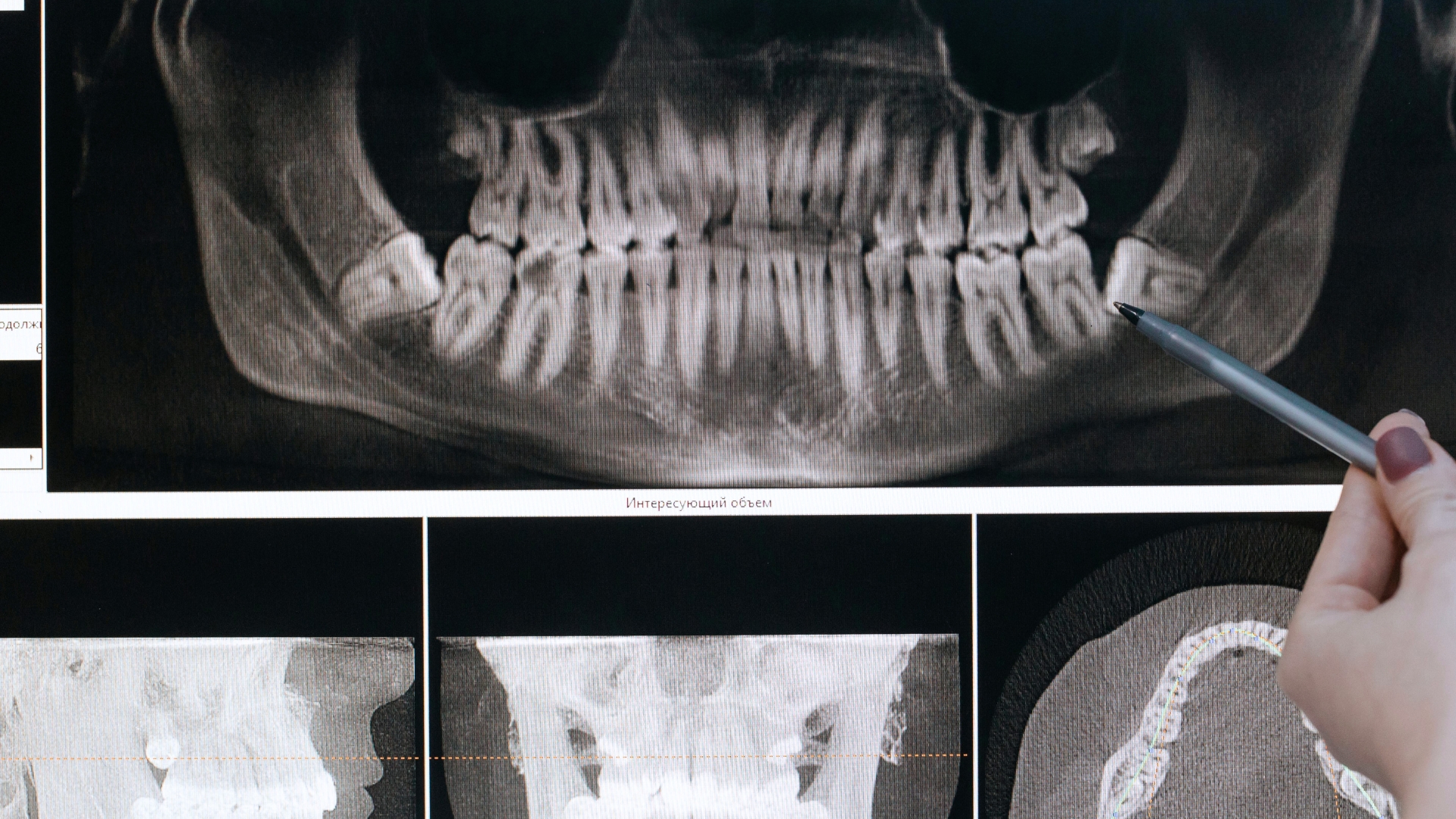 L'immagine rappresenta un bambino mentre va dal dentista.