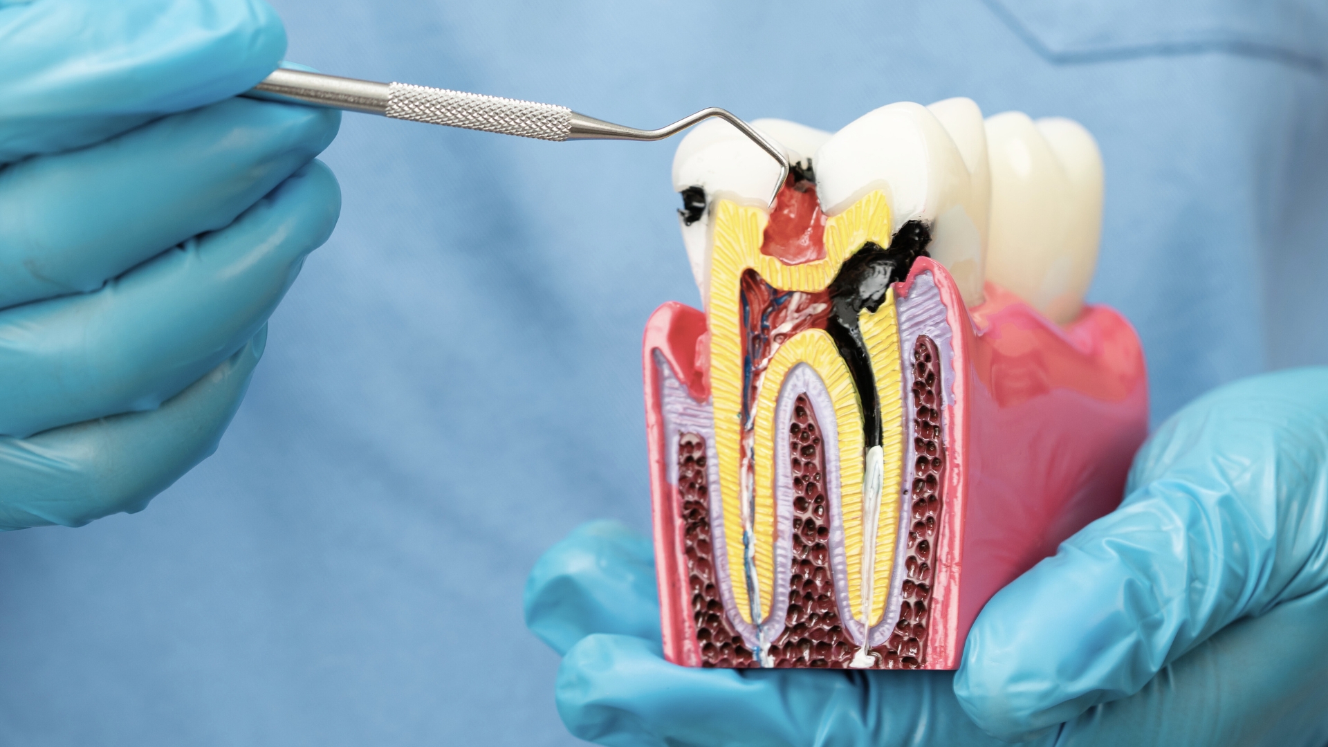 L'immagine rappresenta un bambino mentre va dal dentista.
