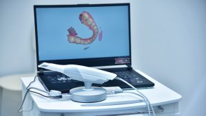 L'immagine rappresenta uno scanner intraorale.
