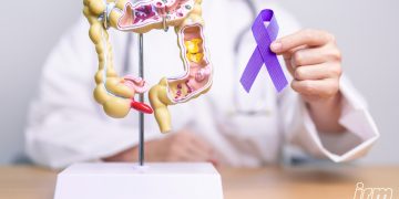 La foto rappresenta un medico che indica l'intestino.